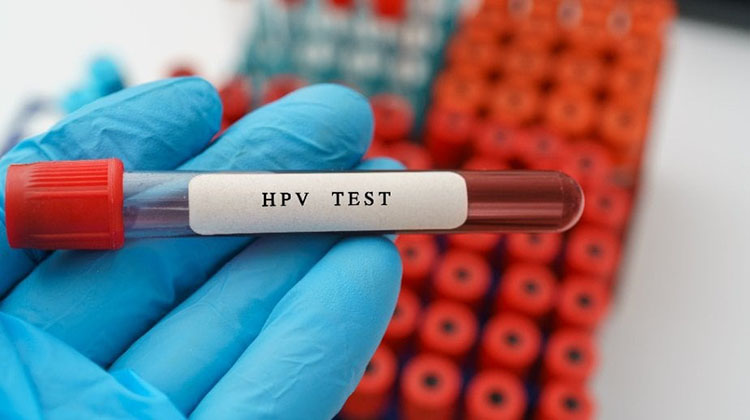 my-texas-health-care-obgyn-HPV