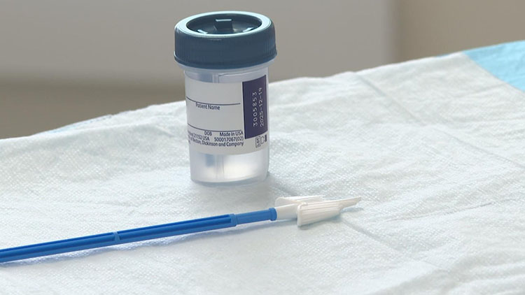 hpv-test.jpg