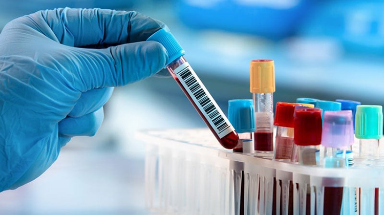 In-vitro-diagnostics