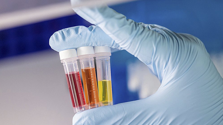 In Vitro Diagnostics